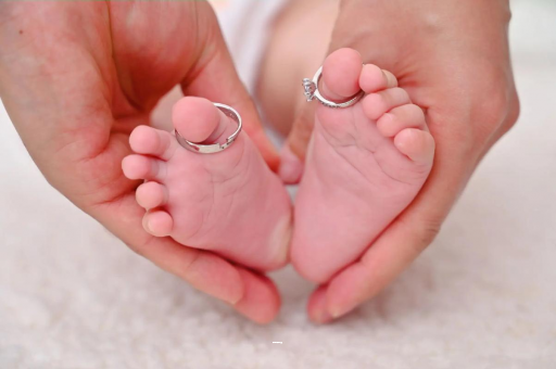 开原孕妇怎样预防妊娠纹